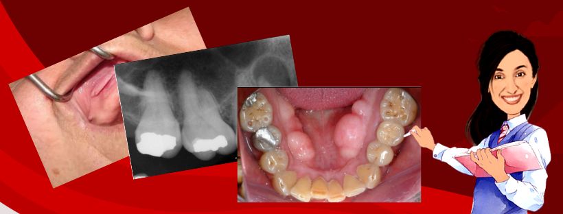 Images Questions Gallery - Dentello Prometric Study Material